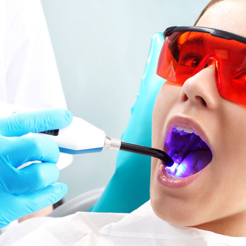 Laser Dentistry