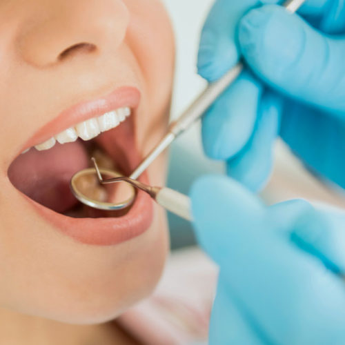 Tooth fillings & Root canal treatment